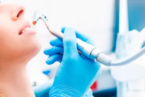 Limpieza y profilaxis dental